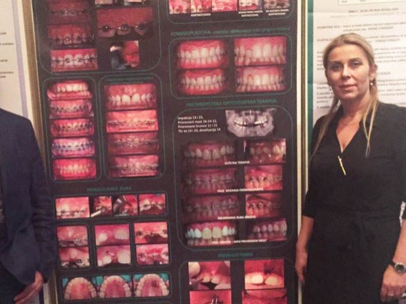 Sudjelovali smo i na 2. Međunarodnom kongresu Hrvatskog ortodontskog društva