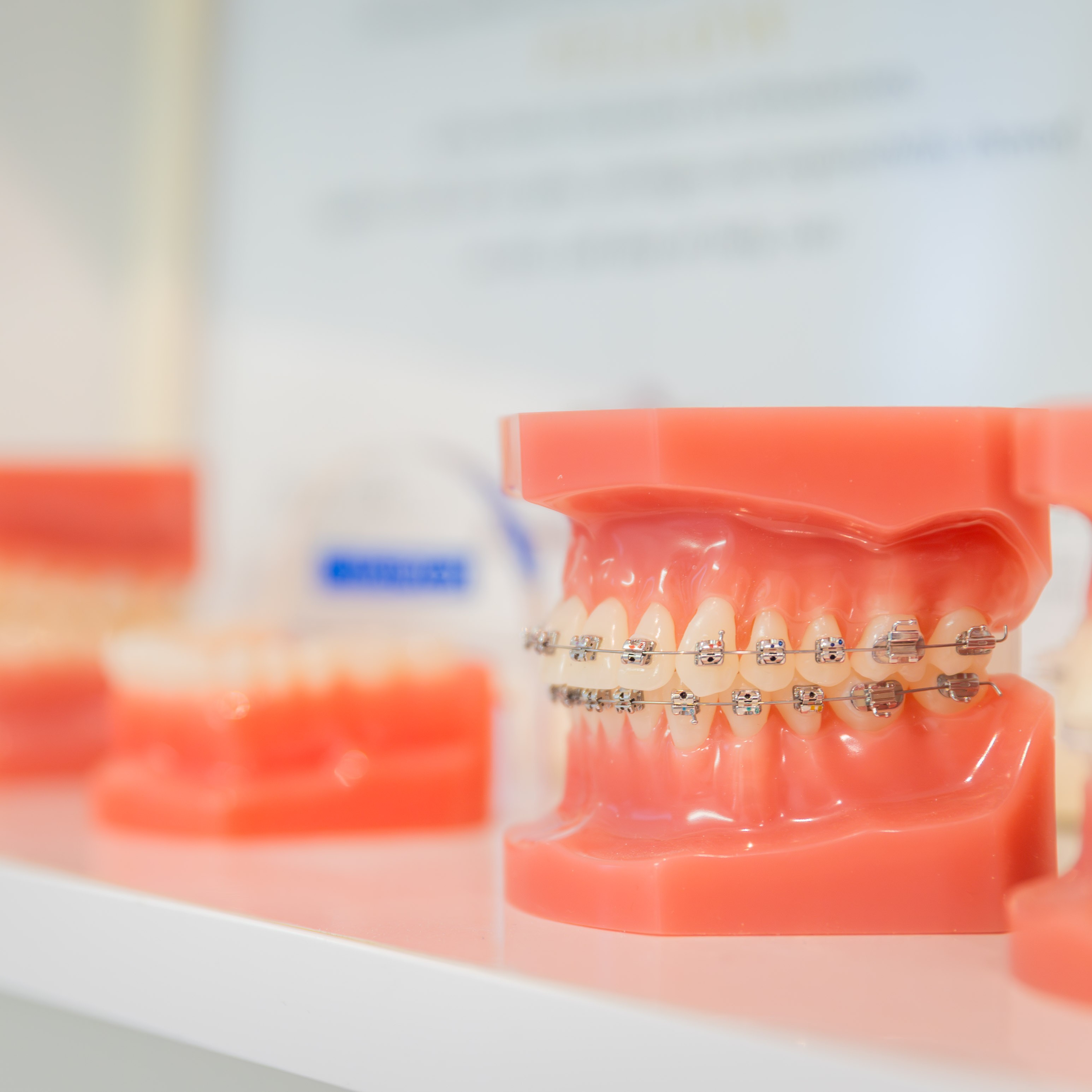 Fiksni ortodontski aparati