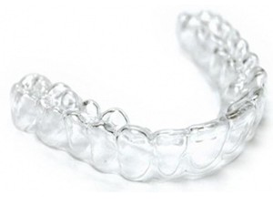 Ortodontska retencija