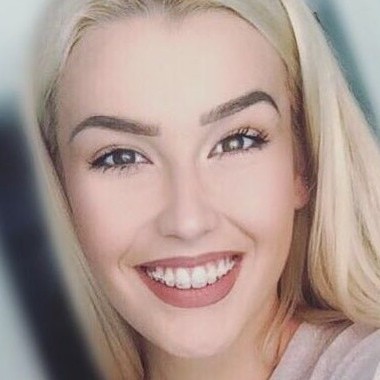 Ortodontske terapije kod odraslih pacijenata